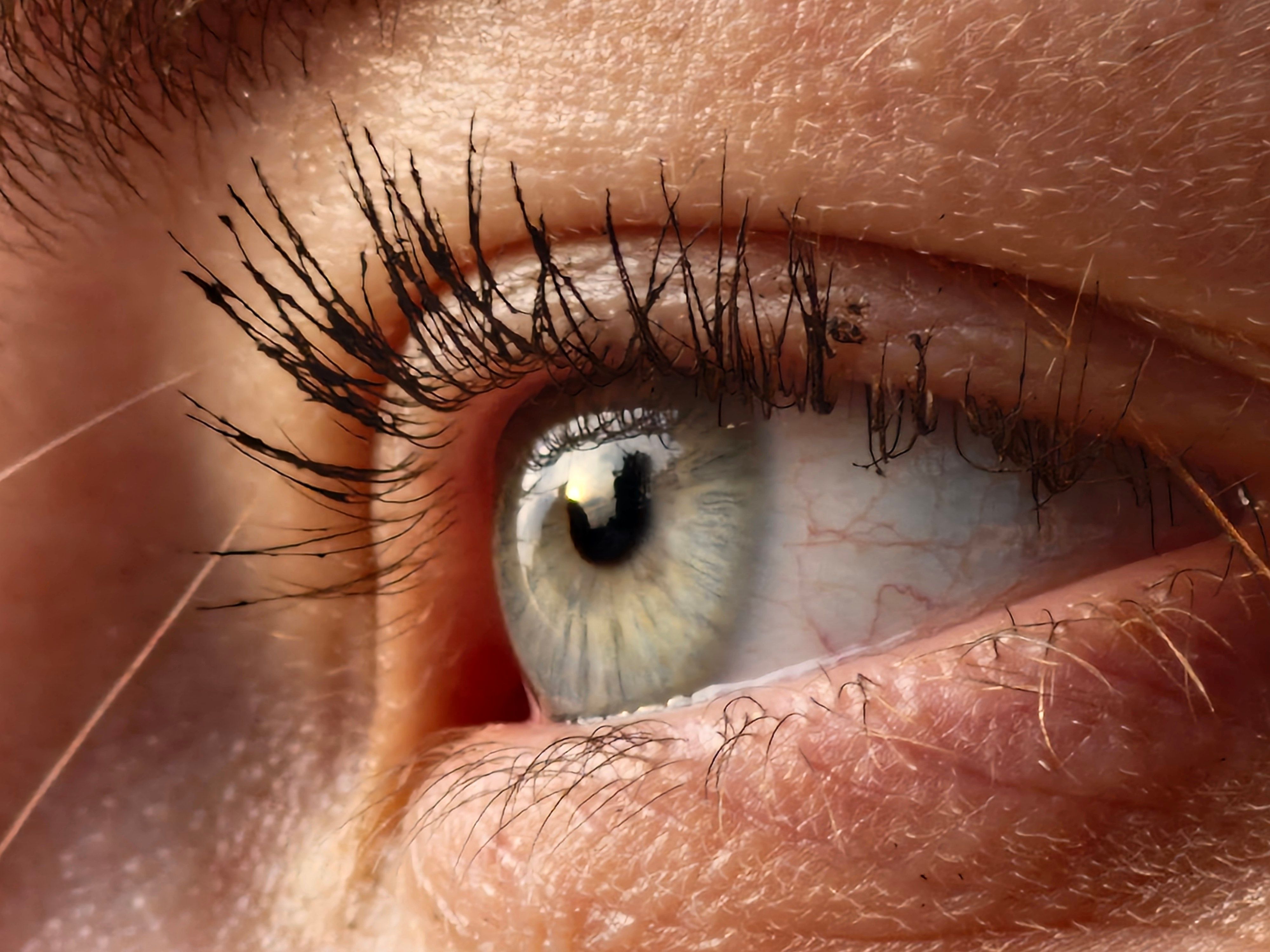 Human eye